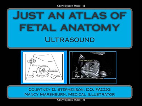 9781490946580: Just an atlas of fetal anatomy: Ultrasound