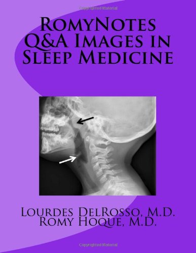Stock image for RomyNotes Q & A Images in Sleep Medicine for sale by Revaluation Books