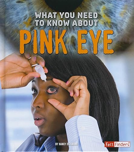 Beispielbild fr What You Need to Know about Pink Eye zum Verkauf von Better World Books