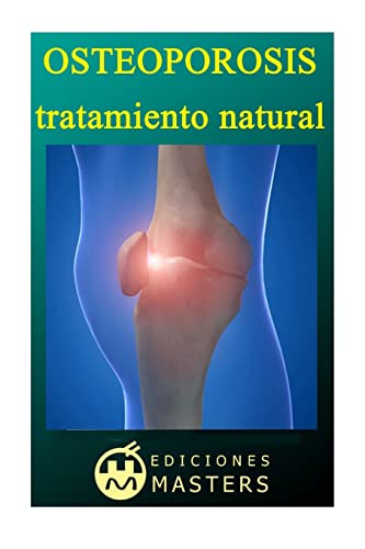 Stock image for Osteoporosis: Tratamiento natural for sale by ThriftBooks-Atlanta
