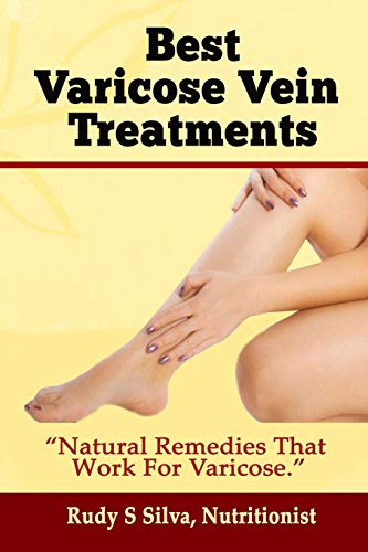 Stock image for Best Varicose Vein Treatments: Natural Remedies That Work for Varicose for sale by Reuseabook