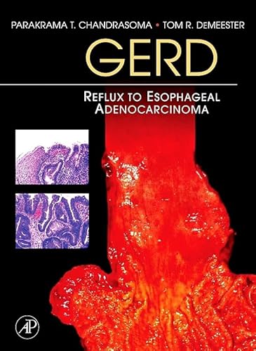 9781493300730: GERD: Reflux to Esophageal Adenocarcinoma