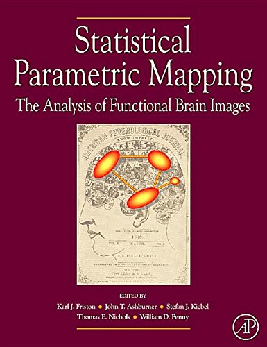 9781493300952: Statistical Parametric Mapping: The Analysis of Functional Brain Images