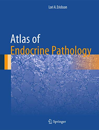 Imagen de archivo de Atlas of Endocrine Pathology (Atlas of Anatomic Pathology) a la venta por Solr Books