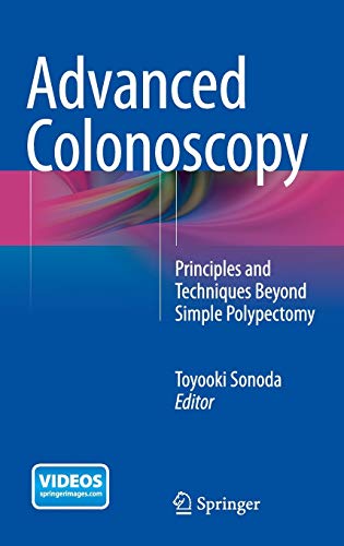 9781493915835: Advanced Colonoscopy: Principles and Techniques Beyond Simple Polypectomy