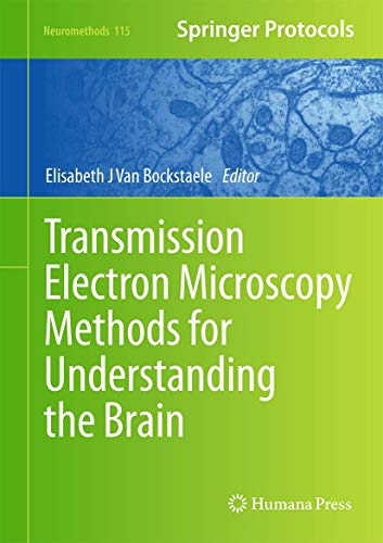 9781493936380: Transmission Electron Microscopy Methods for Understanding the Brain: 115