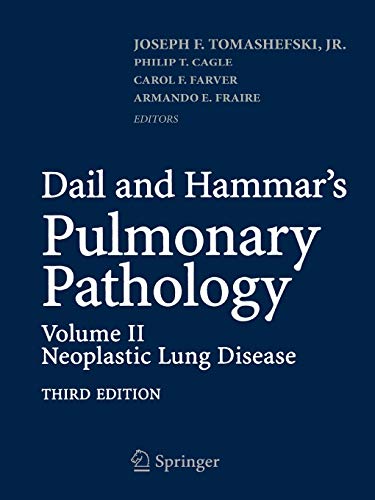 9781493936922: Dail and Hammar's Pulmonary Pathology: Volume II: Neoplastic Lung Disease