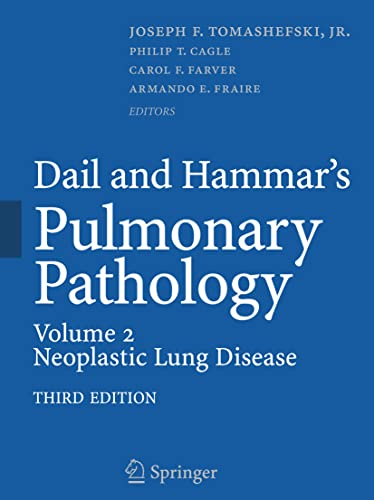 9781493936922: Dail and Hammar's Pulmonary Pathology: Neoplastic Lung Disease: Volume II: Neoplastic Lung Disease
