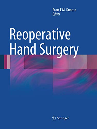 Imagen de archivo de Reoperative Hand Surgery a la venta por Ria Christie Collections