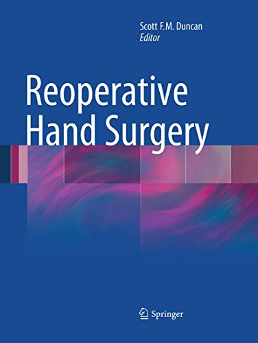 9781493944095: Reoperative Hand Surgery