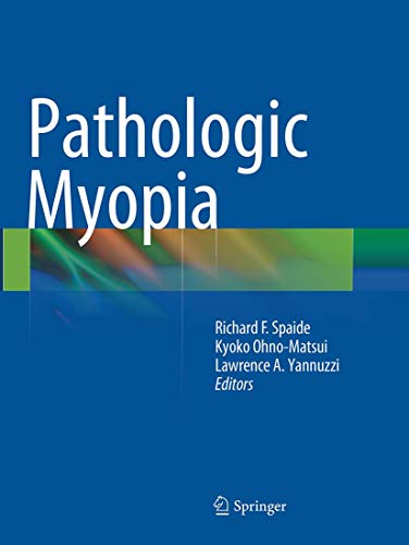 9781493945085: Pathologic Myopia