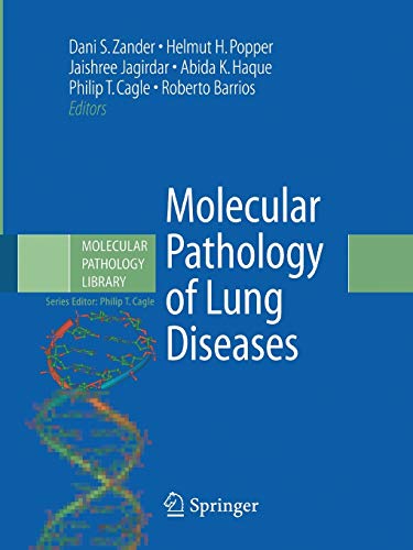 9781493950409: Molecular Pathology of Lung Diseases: 1 (Molecular Pathology Library, 1)