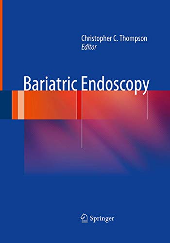 9781493951215: Bariatric Endoscopy