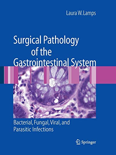 Surgical Pathology of the Gastrointestinal System: Bacterial, Fungal, Viral, and Parasitic Infections - Laura W. Lamps