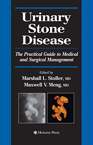 9781493956418: Urinary Stone Disease: The Practical Guide to Medical and Surgical Management