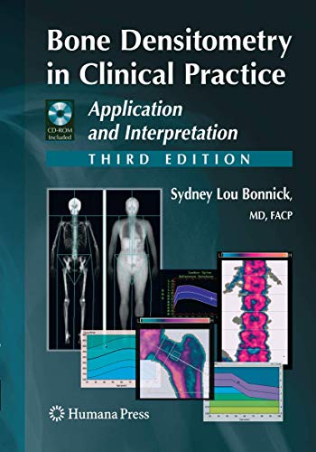9781493960910: Bone Densitometry in Clinical Practice: Application and Interpretation (Current Clinical Practice)