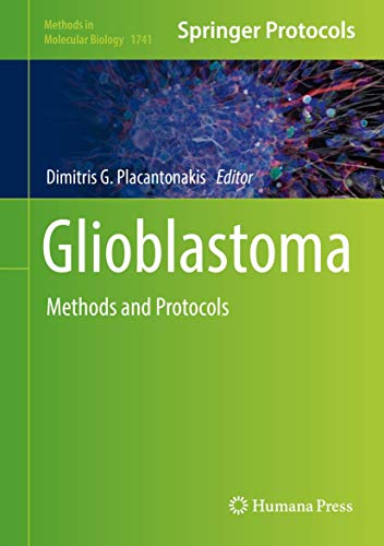 Imagen de archivo de Glioblastoma (Hardcover) a la venta por CitiRetail
