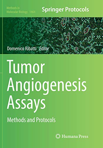 Beispielbild fr Tumor Angiogenesis Assays Methods and Protocols zum Verkauf von Buchpark