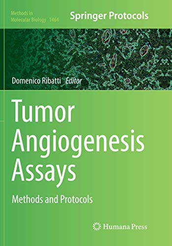 Stock image for Tumor Angiogenesis Assays : Methods and Protocols for sale by Chiron Media