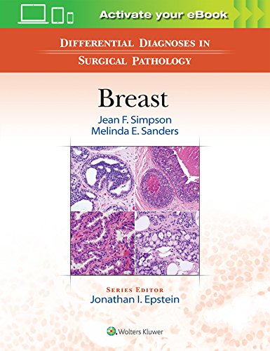 Beispielbild fr Differential Diagnoses in Surgical Pathology: Breast zum Verkauf von Better World Books