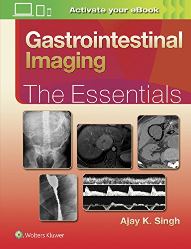 Imagen de archivo de Gastrointestinal Imaging: The Essentials (Essentials Series) a la venta por HPB-Red