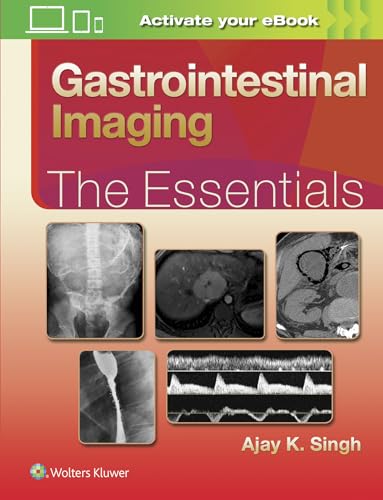 Stock image for Gastrointestinal Imaging: The Essentials (Essentials Series) for sale by HPB-Red
