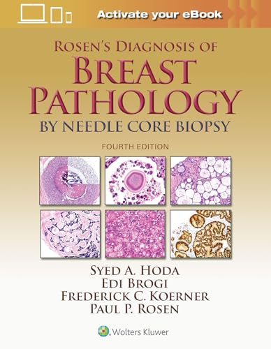 Imagen de archivo de Rosen's Diagnosis of Breast Pathology by Needle Core Biopsy a la venta por Save With Sam