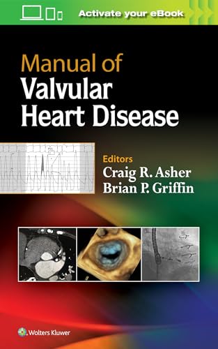 Stock image for Manual of Valvular Heart Disease for sale by HPB-Red