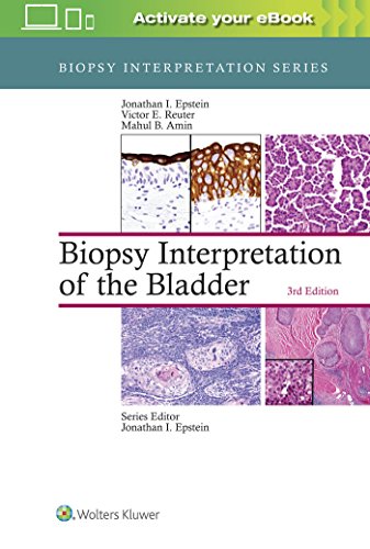 Imagen de archivo de Biopsy Interpretation of the Bladder (Biopsy Interpretation Series) a la venta por BGV Books LLC