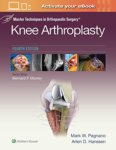 Imagen de archivo de Master Techniques in Orthopedic Surgery: Knee Arthroplasty (Master Techniques in Orthopaedic Surgery) a la venta por BooksRun