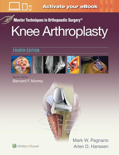 Stock image for Master Techniques in Orthopedic Surgery: Knee Arthroplasty (Master Techniques in Orthopaedic Surgery) for sale by BooksRun