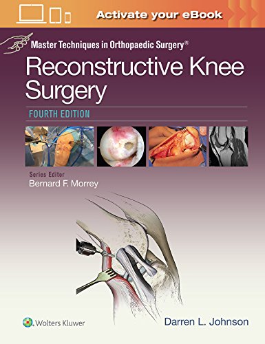 9781496318275: Master Techniques in Orthopaedic Surgery: Reconstructive Knee Surgery