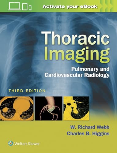 Imagen de archivo de Thoracic Imaging: Pulmonary and Cardiovascular Radiology a la venta por Scubibooks
