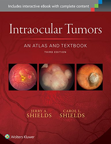 9781496321343: Intraocular Tumors: An Atlas and Text