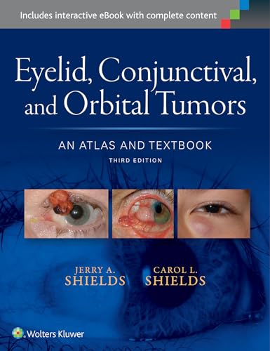 Imagen de archivo de Eyelid, Conjunctival, and Orbital Tumors: An Atlas and Textbook a la venta por Scubibooks