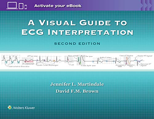 Stock image for A Visual Guide to ECG Interpretation for sale by Scubibooks