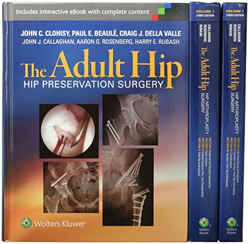 9781496321961: The Adult Hip 3-Volume Package: Arthroplasty and its Alternatives and Hip Preservation Surgery