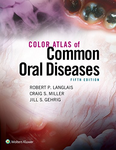 Beispielbild fr Color Atlas of Common Oral Diseases zum Verkauf von Wrigley Books