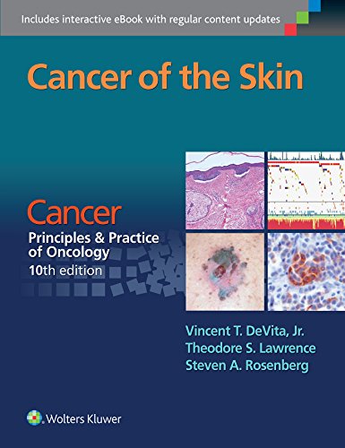Stock image for Cancer of the Skin Cancer: Principles and Practice of Oncology, 10th Edition for sale by TextbookRush
