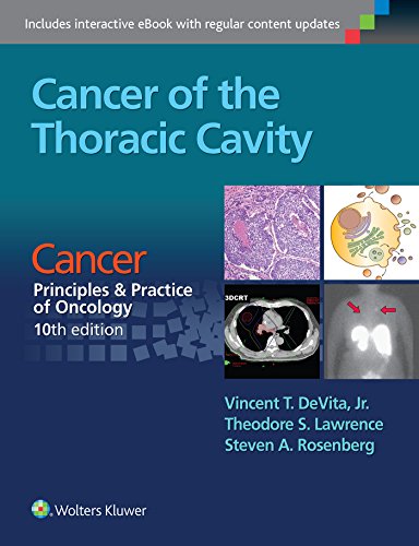 Stock image for CANCER OF THE THORACIC CAVITY CANCER: PRINCIPLES AND PRACTICE OF ONCOLOGY 10ED (PB 2016) for sale by Romtrade Corp.