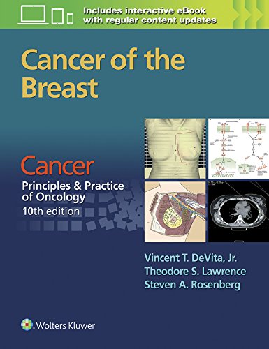 9781496333988: Cancer of the Breast: Cancer: Principles & Practice of Oncology