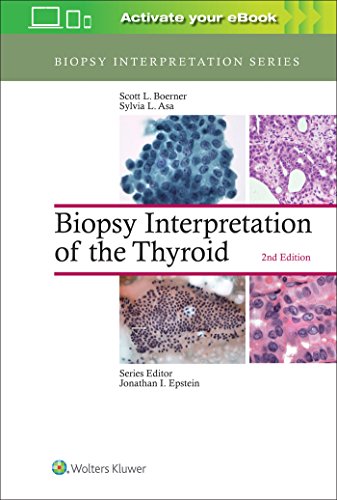 Imagen de archivo de Biopsy Interpretation of the Thyroid (Biopsy Interpretation Series) a la venta por Scubibooks