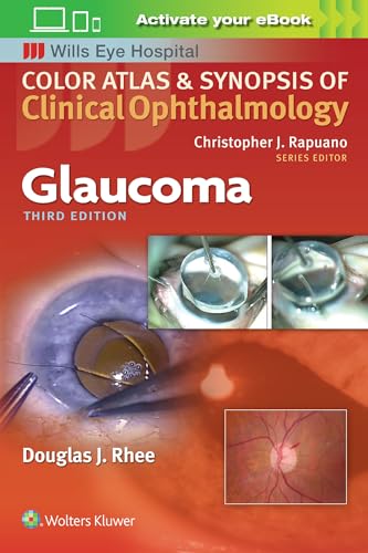 Imagen de archivo de Glaucoma (Color Atlas and Synopsis of Clinical Ophthalmology) a la venta por Byrd Books