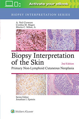 Beispielbild fr Biopsy Interpretation of the Skin: Primary Non-Lymphoid Cutaneous Neoplasia (Biopsy Interpretation Series) zum Verkauf von Scubibooks