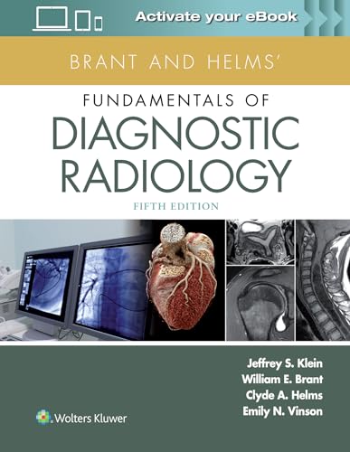 Stock image for Brant and Helms' Fundamentals of Diagnostic Radiology for sale by GoldenWavesOfBooks