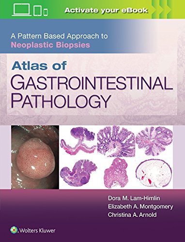 Beispielbild fr Atlas of Gastrointestinal Pathology: A Pattern Based Approach to Neoplastic Biopsies zum Verkauf von Scubibooks