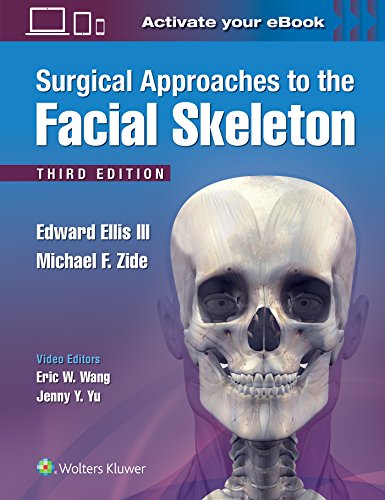 9781496380418: Surgical Approaches to the Facial Skeleton