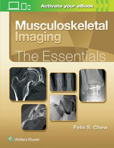 Stock image for Musculoskeletal Imaging: The Essentials for sale by Basi6 International