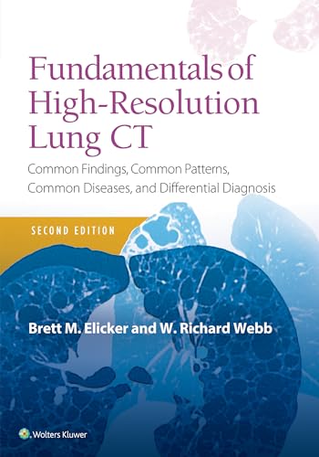 Imagen de archivo de Fundamentals of High-Resolution Lung CT: Common Findings, Common Patterns, Common Diseases and Differential Diagnosis a la venta por BooksRun