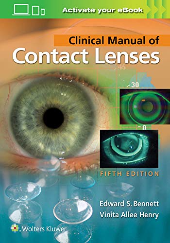 9781496397799: Clinical Manual of Contact Lenses